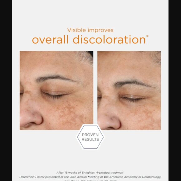 NIB NEOSTRATA Enlighten Illuminating Serum Full Size 1 Fl Oz Retail Price $88.00 - Picture 6 of 6